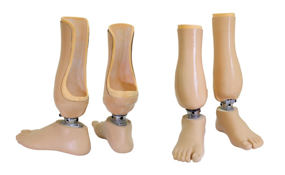 Ortho-Lite-prosthetics